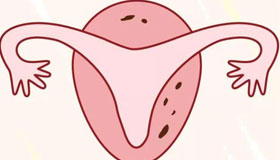 女方子宫内膜